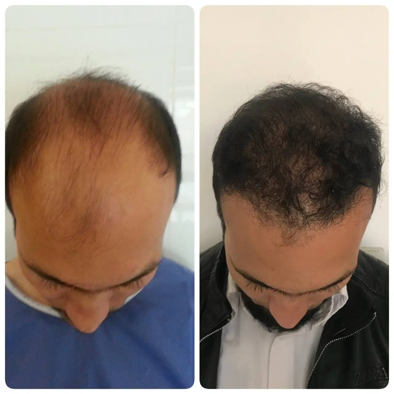 kasht moo before after (2)