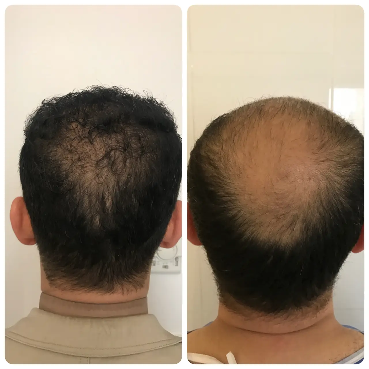 kasht moo before after (3)