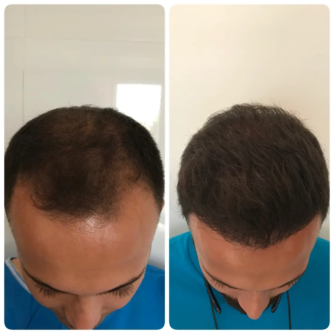 kasht moo before after (4)