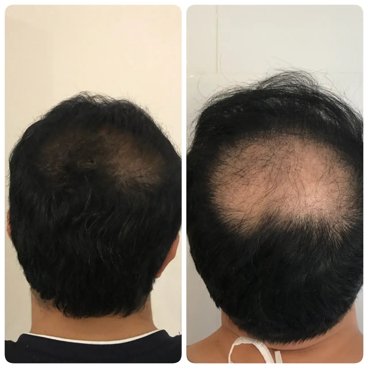 kasht moo before after (5)