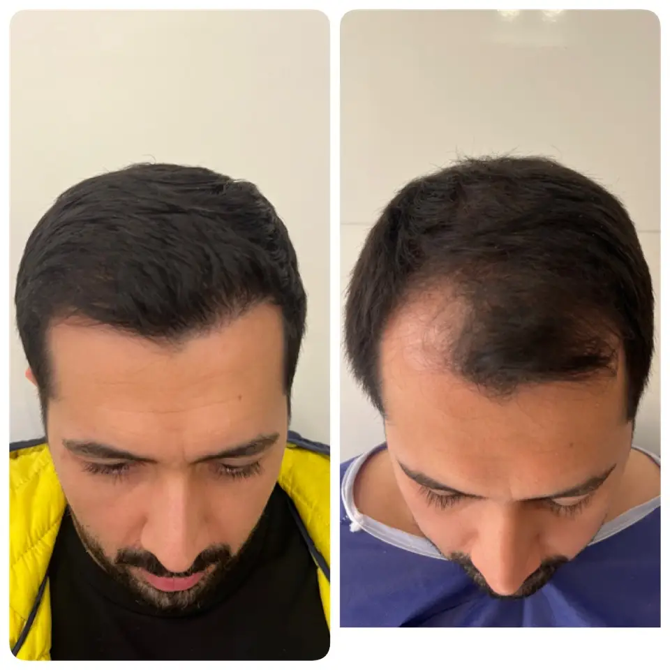 kasht moo before after (6)
