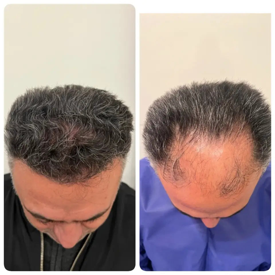 kasht moo before after (7)