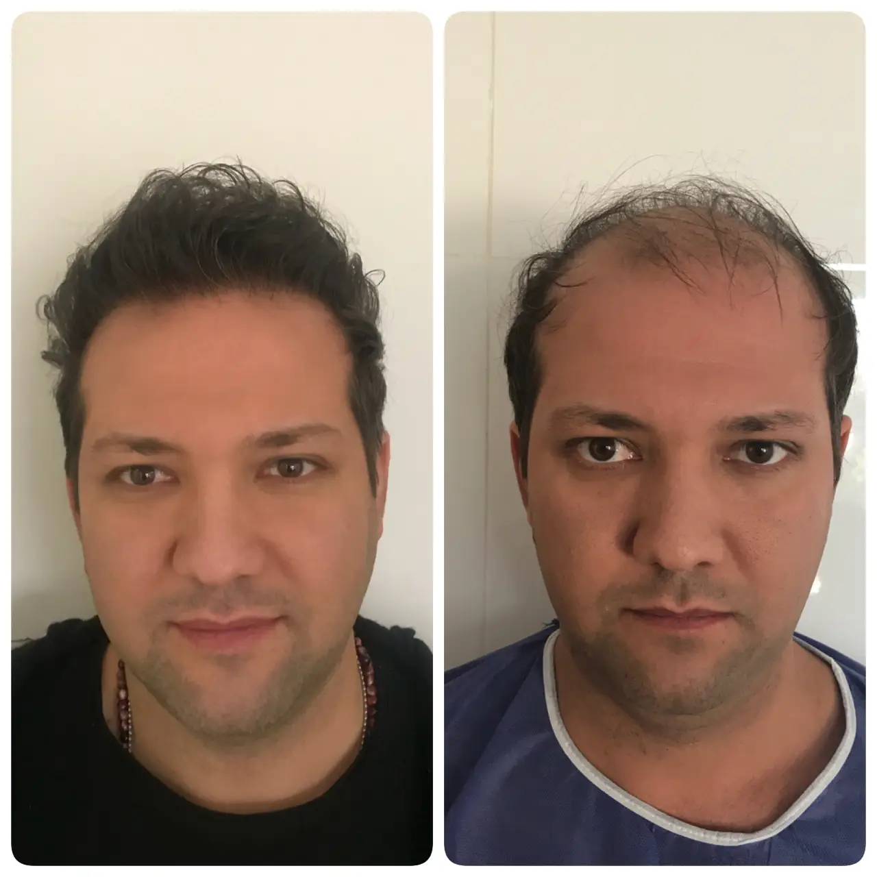 kasht moo before after (8)
