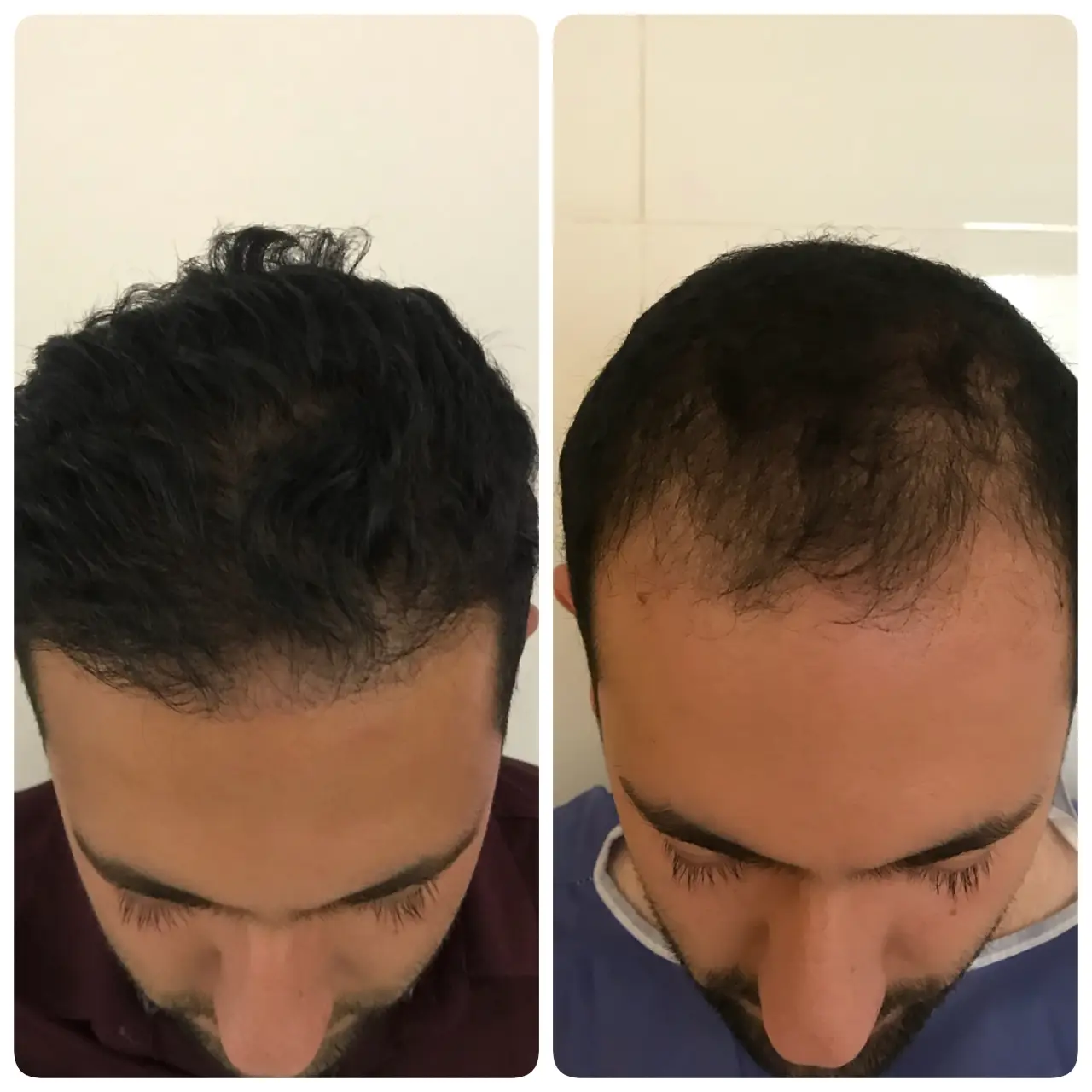 kasht moo before after (9)